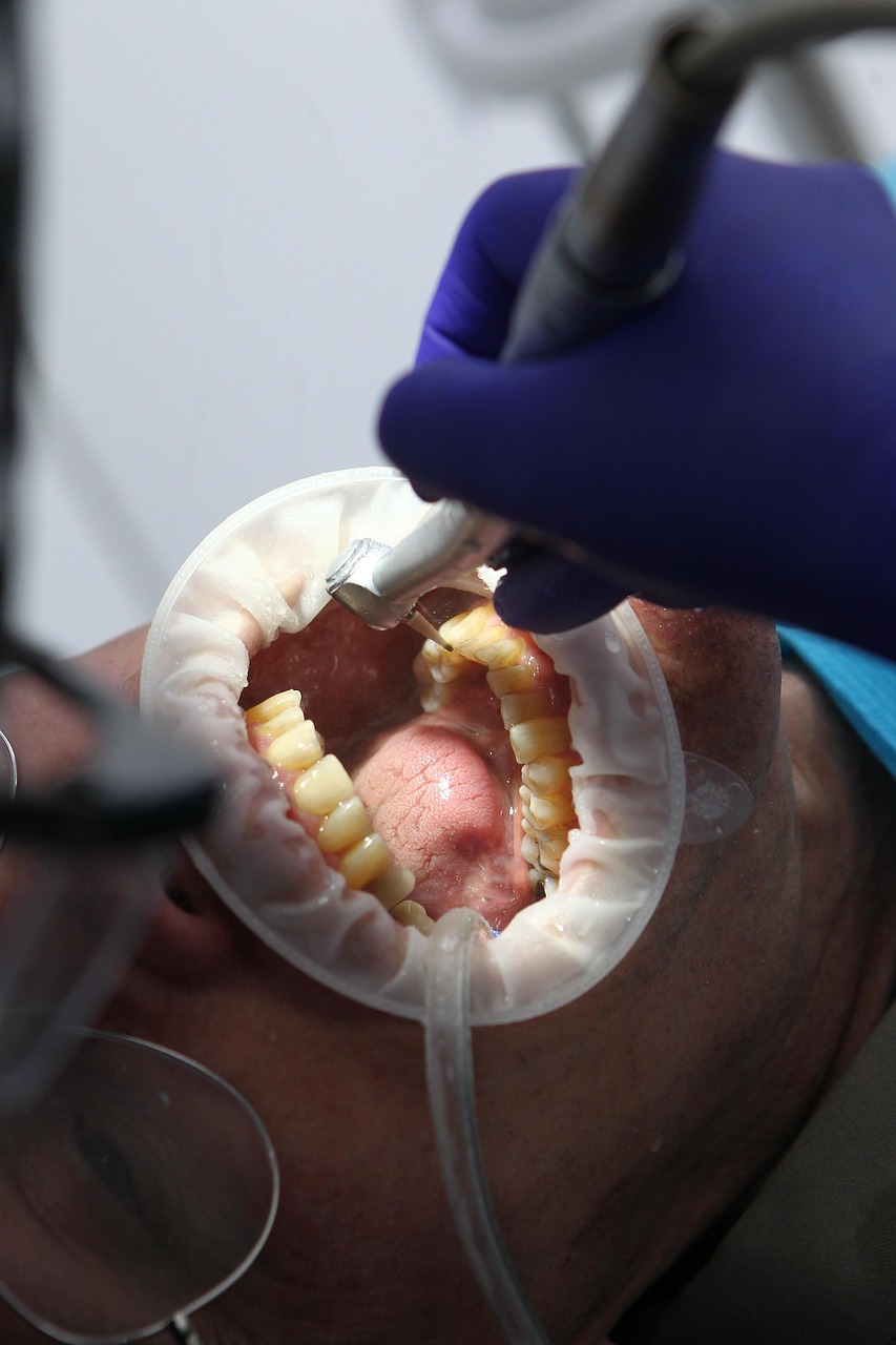 Consulta dental, imagen de muestra de Pixabay